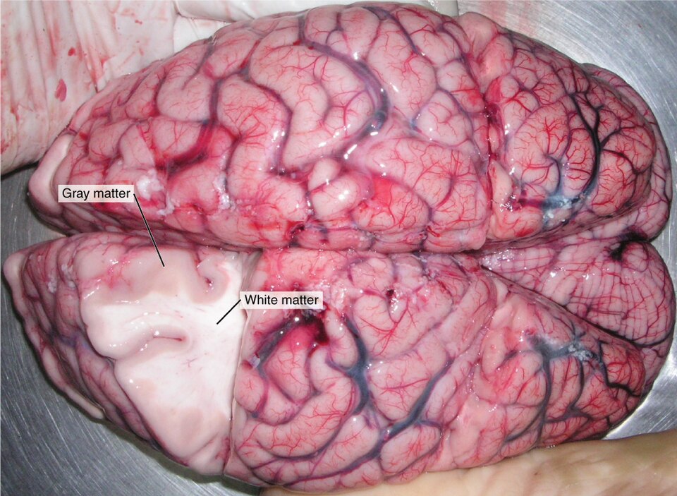 Gray and white matter are shown on a human brain with overlayed text labels