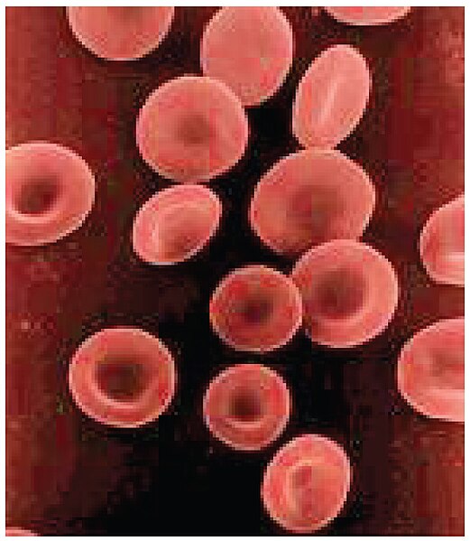 “1903_Shape_of_Red_Blood_Cells” by OpenStax College is licensed under CC BY 3.0 Micrograph showing red blood cells
