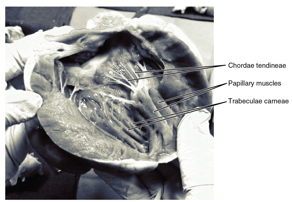 This image is derivative of “Papillary muscle. 220/365” by PK VS and is licensed under CC BY 2.0 Chordae tendineae, papillary muscles, and trabeculae carneae