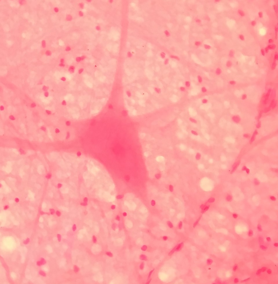 Microscopic section of neural tissue