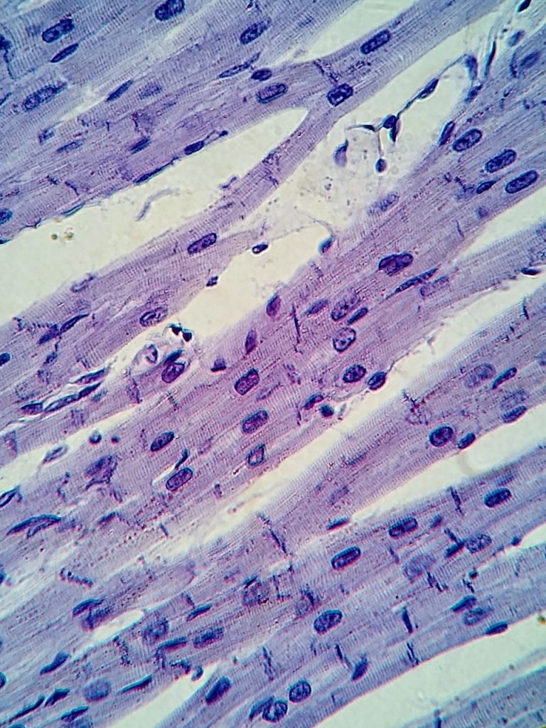 "Cardiac_muscle_histology_400x" by Alexander G. Cheroske is licensed under CC BY-SA 4.0 Micrograph showing cardiac muscle