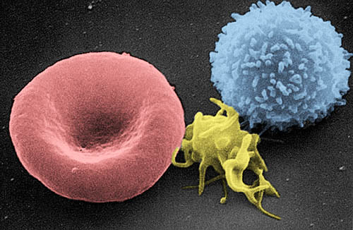 "Red_White_Blood_cells" by lectron Microscopy Facility at The National Cancer Institute at Frederick (NCI-Frederick) is in Public Domain. Colored Scanning electron microscope (SEM)-picture showing the erythrocyte, thrombocyte, and leukocyte
