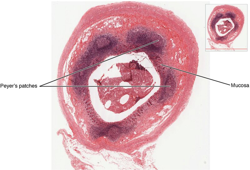 ”2210_Mucosa_Associated_Lymphoid_Tissue_(MALT)_Nodule” by OpenStax College is licensed under CC BY 3.0 Illustration showing mucosa associated lymphoid tissue nodule or MALT