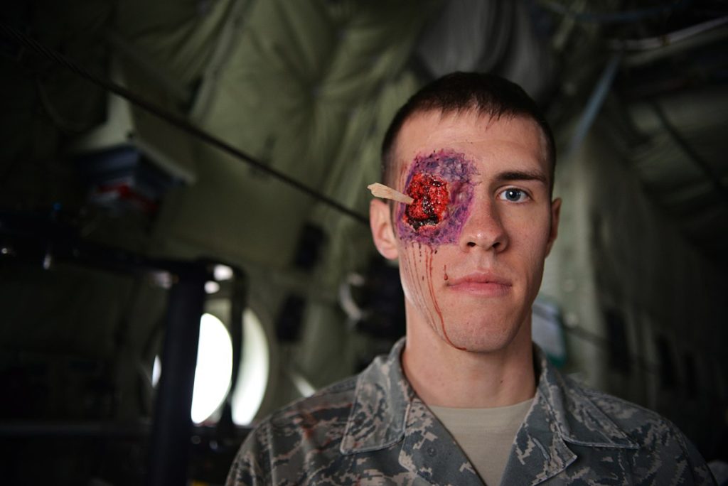 A military personnel with a simulated penetrating trauma to the eye