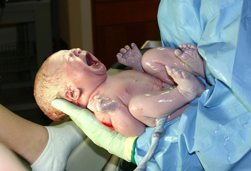 A medical provider is holding a newborn with their umbilicus still attached