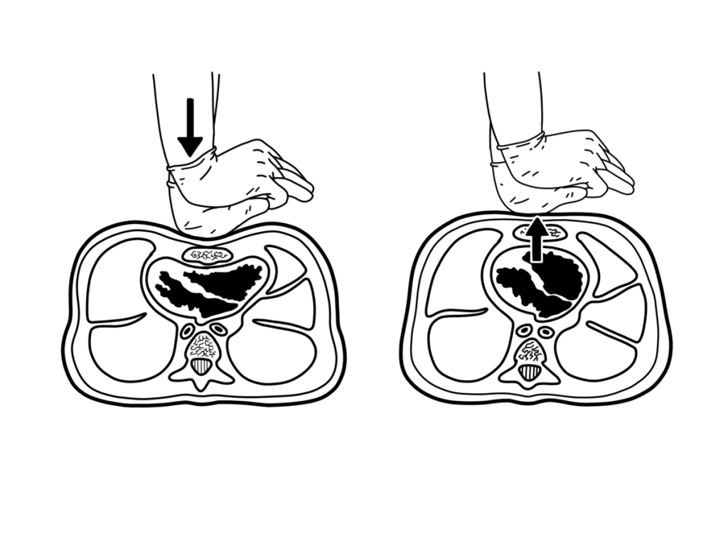 Illustration showing heart compression during CPR