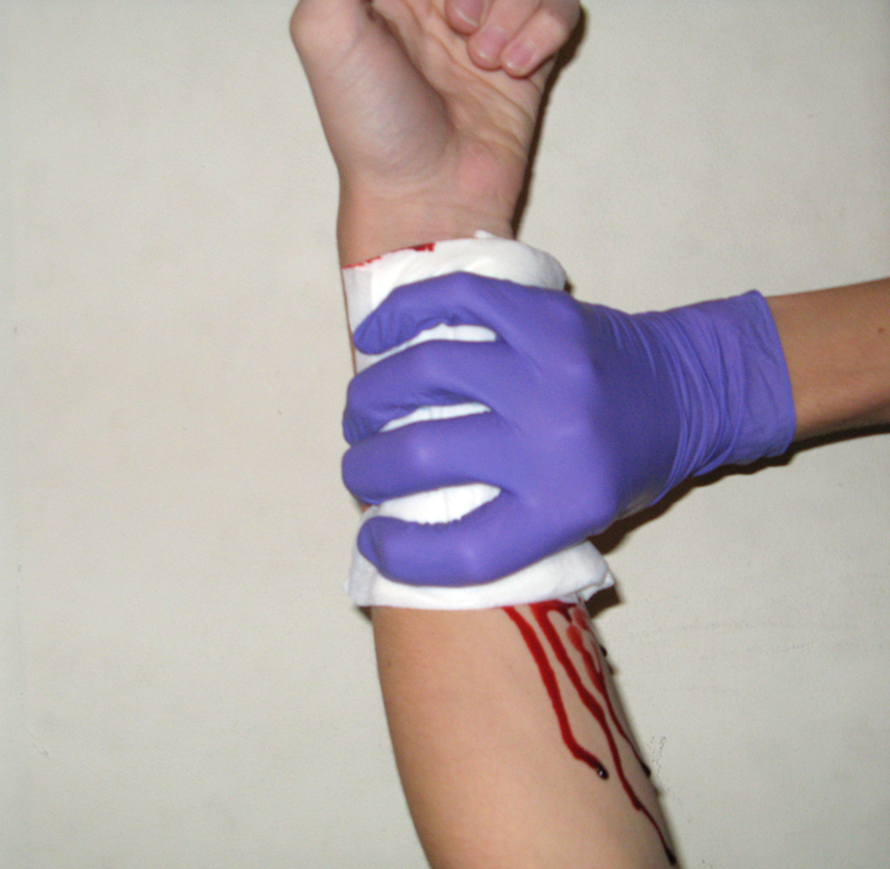 A gloved hand is applying direct pressure to gauze covering a bleeding wound on a forearm