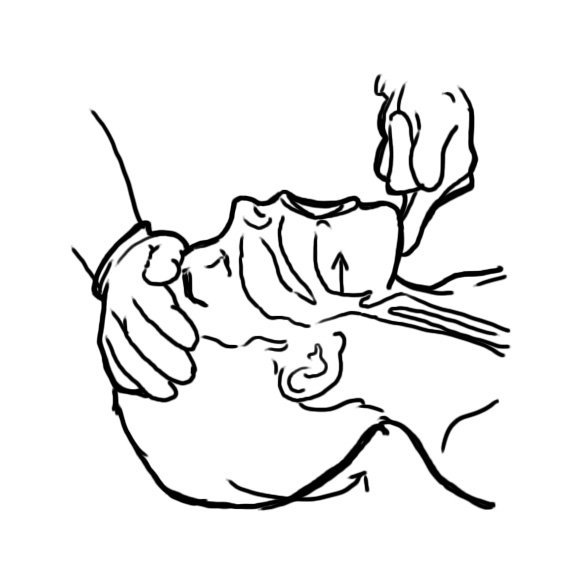 Illustration showing the head tilt chin lift maneuver on a simulated patient