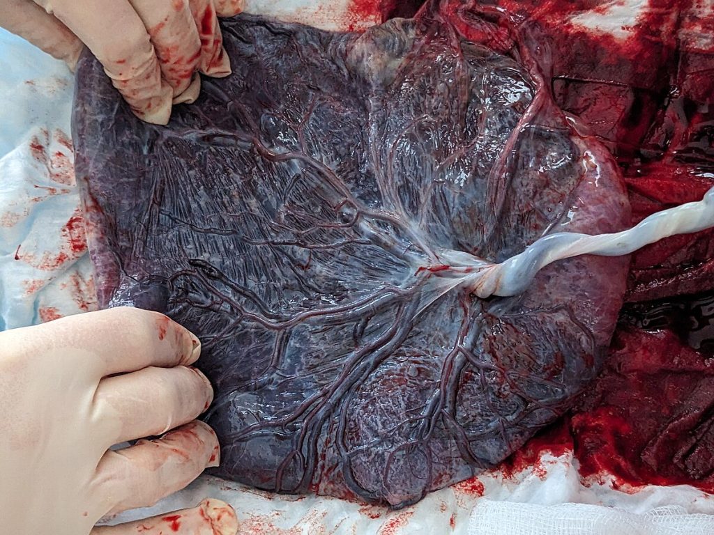 a human placenta, just after delivery