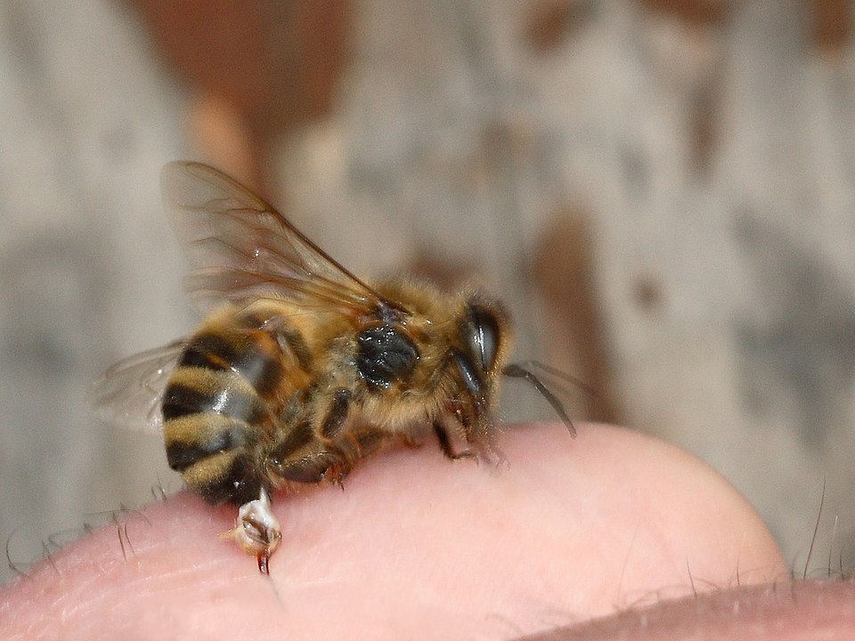 Closeup of a bee that has stung the skin. The barbed stinger is torn off and remains in the skin
