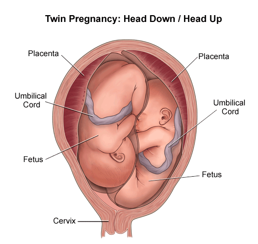 Illustration showing a twin breech