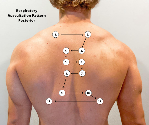 “Posterior Respiratory Auscultation Pattern.png” by Meredith Pomietlo for Chippewa Valley Technical College is licensed under CC BY 4.0 Posterior auscultation pattern